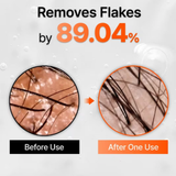 LILYEVE Hair Grow Turn Exosome Brush Ampoule Treatment