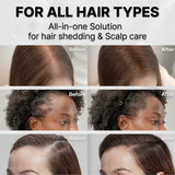 LILYEVE Hair Grow Turn Exosome Brush Ampoule Treatment